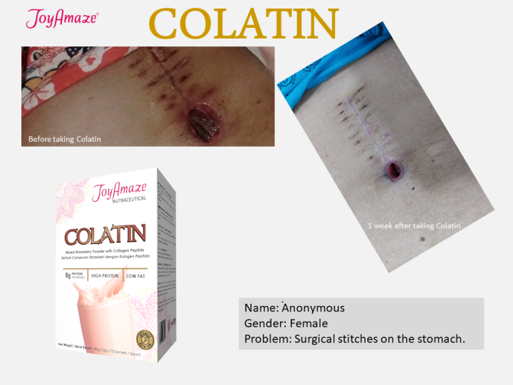 Colatin Testimonies