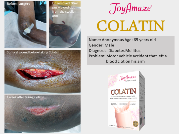 Colatin Testimonies