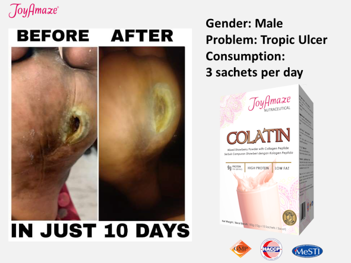 Colatin Testimonies
