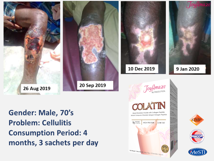 Colatin Testimonies