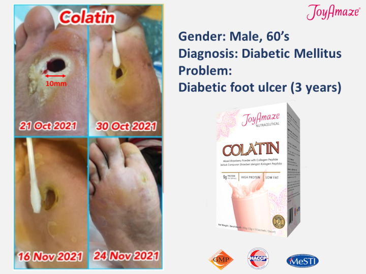 Colatin Testimonies