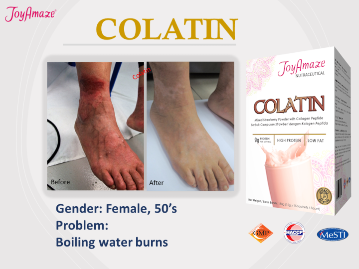 Colatin Testimonies