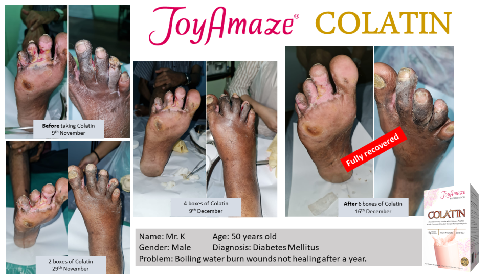 Colatin Testimonies